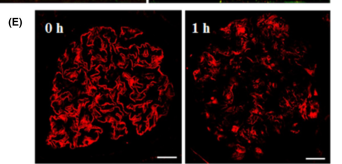 Immunfluoreszenz Glomerulus. Vor und nach Reperfusion deutlich geändertes Muster von Anti-Nephrin-Ig.