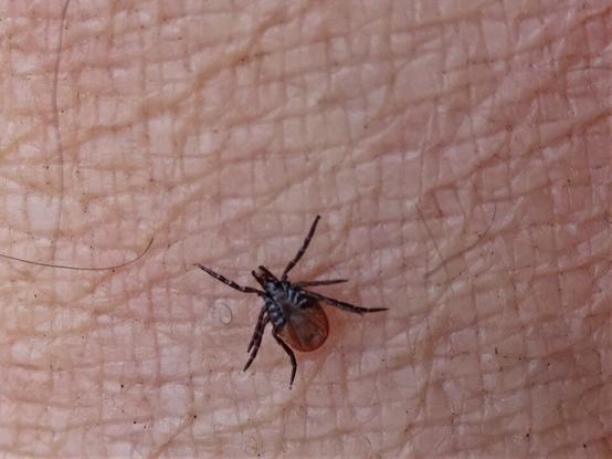 Ausgewachsene Zecke auf der Haut.