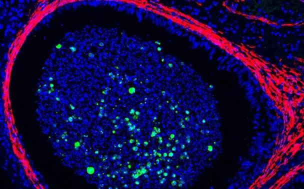 Иммунофлуоресцентное окрашивание образца придатка яичка макаки-крабоеда, инфицированной оспой обезьян. Зеленым светится вирус, красным — границы просвета придатка, где созревает и хранится сперма. Ядра клеток окрашены синим.
Credit: Dr. Xiankun (Kevin) Zeng, USAMRIID