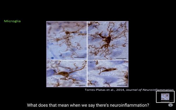 A snapshot of cells in our CNS called Microglia. The picture shows when they are calm and when they flare up & branch out when they detect pathogens.