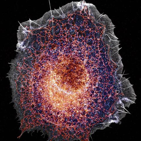 A COS cell stained for actin filaments (gray), clathrin pits (blue) and the endoplasmic reticulum (orange), imaged with our SoRa super-resolved spinning-disk microscope