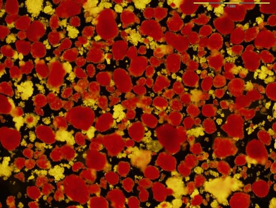 Pancreatic islets of Langerhans