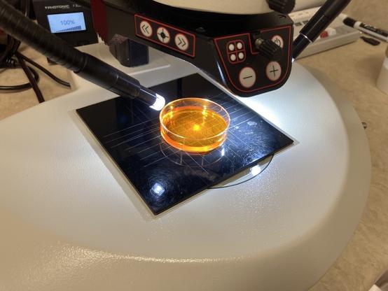Islets under a microscope