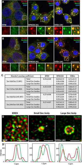 Fig. 2 of the article showing that Sec16A-positive structures contain COPII subunits