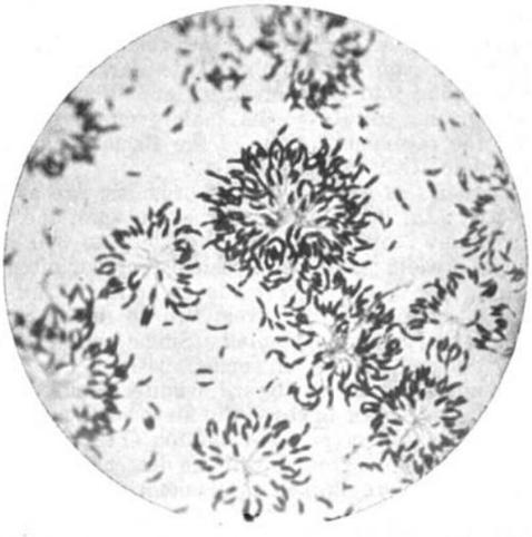 Mabel Jones, 1905. Caulobacter-like rosettes from a bug isolated from Chicago tap water