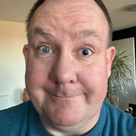 Selfie of full on sarcasm sporting a fully dilated pupil in my left eye.