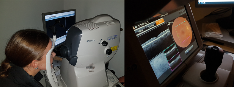Two photos. On the left, a person puts their chin on a rest while looking into a machine for scanning their eyes. On the right, a computer screen shows the resulting OCT and fundus image for analysis, a joystick is visible in front of the screen.