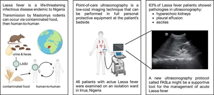 Three figures: 1. showing the modes of transmission of Lassa Virus to humans from Mastomys rodents, contaminated food or between humans. A globe shows Nigeria as endemic area. 2. showing a graphic with a point-of-care ultrasound and a patient 3. showing an ultrasound. ©Journal of infection