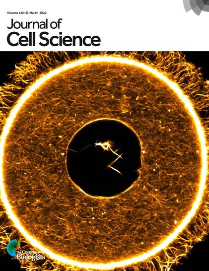 Super-resolution microscopy image of phalloidin-labelled cytoplasmic and nuclear F-actin structures in a prophase-arrested mouse oocyte. See article by K. Scheffler et al. (jcs259807).