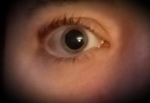 Close up of my eye with extremely dilated pupil.