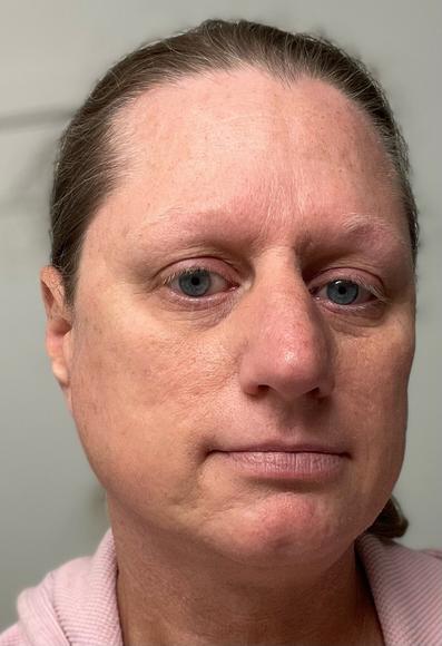 My face close up with no makeup and hair pulled back