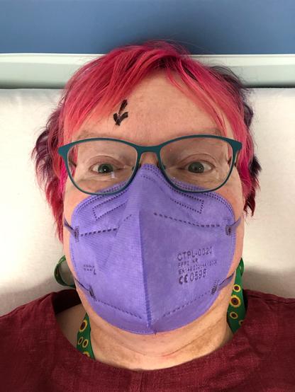 Anna in close-up, lying on a hospital bed. A black arrow is drawn on her forehead, pointing to her right eye. She is wearing a lilac FFP2 mask and a sunflower lanyard. She has green-framed glasses and pink-red-purple dyed short hair.