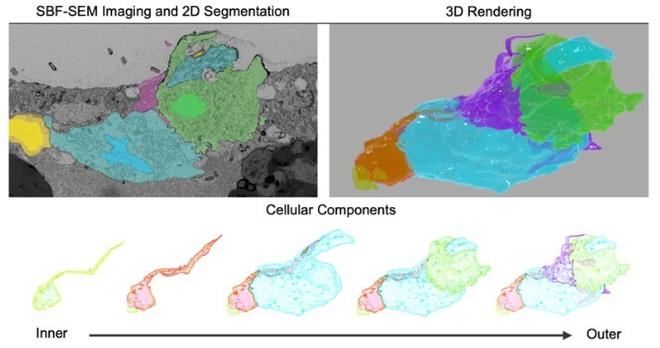 Electron micrograph and 3D rendering of tactile organ in Drosophila