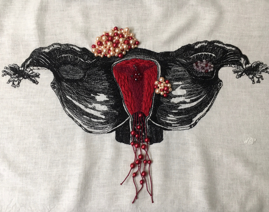 Bleeding Vessel (2022)  For Twitter:  An embroidery of a uterus, including Fallopian tubes and ovaries, stitched in black thread on white linen textured like a woodcut. Inside the uterus, the endometrium is thickly stitched in bright red and burgundy. There is a large fibroid on the top of the uterus and a smaller fibroid on the right lower side, both beaded in red, pink, and cream beads. A cyst on the right ovary is beaded in clear, purple, and red beads, and a small section of dark red and purple beads is a polyp inside the uterus. Long burgundy strings hang from the bottom of the uterus with red beads on them that extend past the vaginal opening. 