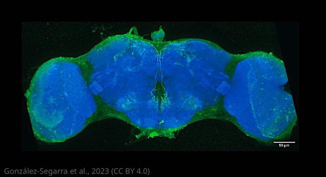 blue and green Light microscopy image of drosophila brain