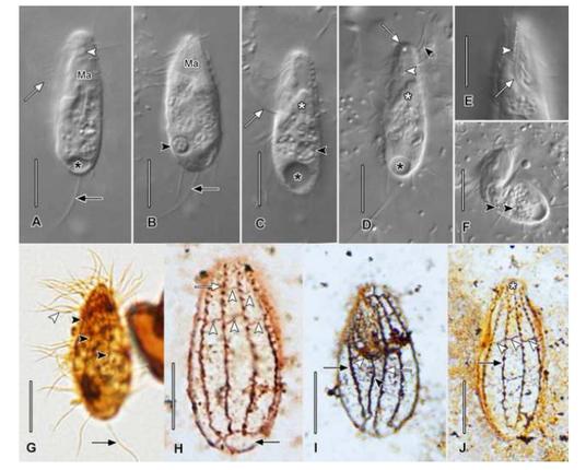 microscopic pictures of ciliates
