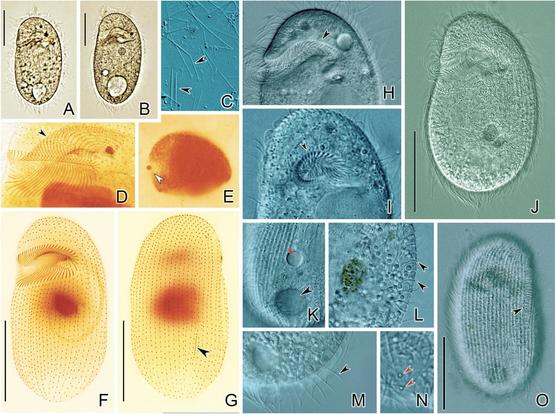 microscopic photos of a ciliate