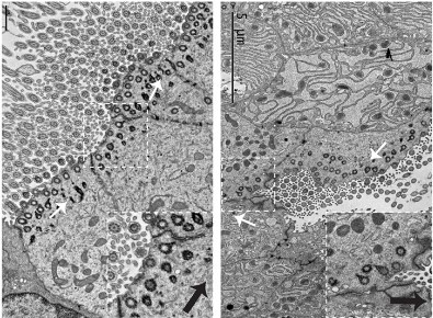 Electron micrographs showing that cilia are misoriented in the airway of an E18.5 Wnt4-/- mutant mouse.