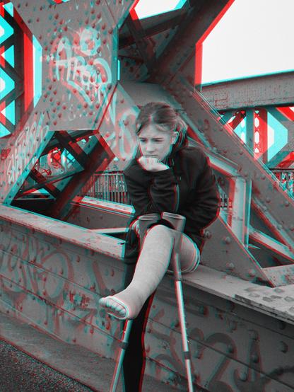 3D Bild (Anaglyphe Brille notwendig) eines Mädchens mit Gipsbein, das auf einer Brücke sitzt. Das Gipsbein ist auf die Krücken gestützt.