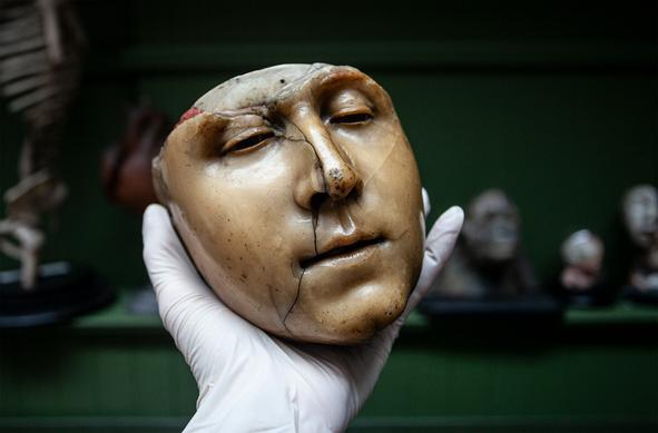 An example of a specimen from the Old Anatomy Museum. A hand, wearing a rubber glove, is holding up a wax model of a head.