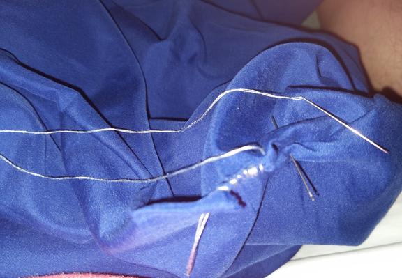 A blue bed spread with some needles and thread. Near the center is some stitches through the bed spread.