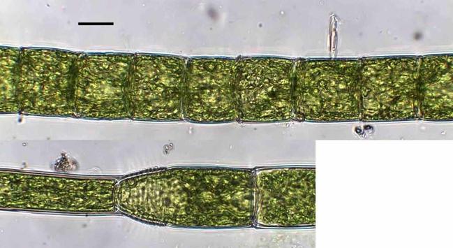 Microscopic photos of a green filamentous alga