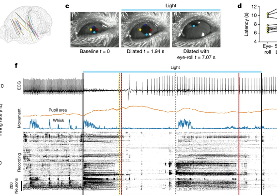 Neuropixels recordings during induction of mouse fainting thru vagal stimulation. Neural activity raster, sorted by rastermap, shows a significant decrease in activity after fainting -- shown by the yellow line.
