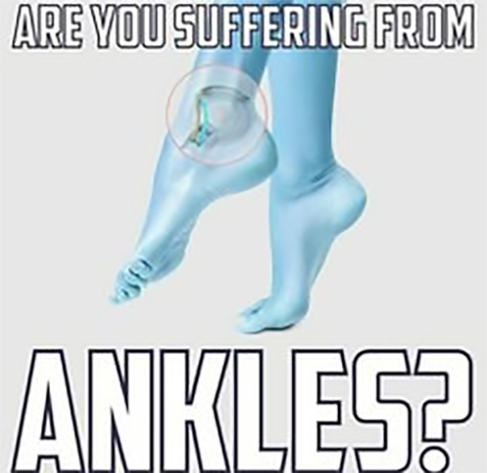 A meme. The image shows a picture of some feet with the ankle shown in focus, The text reads "Are you suffering from ANKLES?"