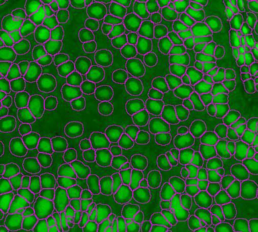 A fluorescent micrograph of DNA-stained cells where each cell is highlighted with a magenta outline.