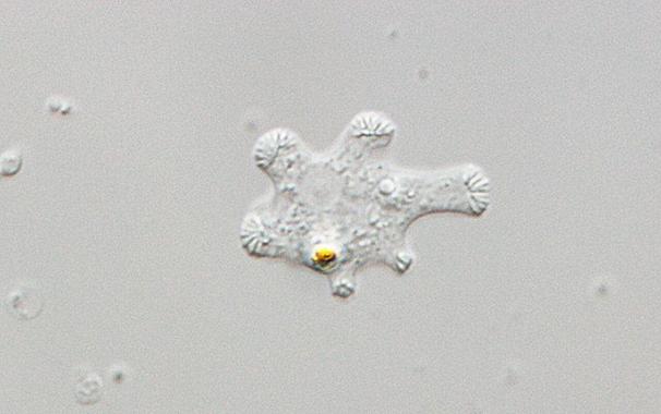 microscopic photo of the amoeba - a shapeshifting microbe with multiple lobes
