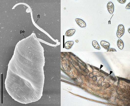 Left: Scanning electron micrograph of Euglenaformis parasitica. Top Right: E. parasitica extracted from an ostracod host. Bottom Right: E. parasitica visible in the appendage of an infected ostracod.