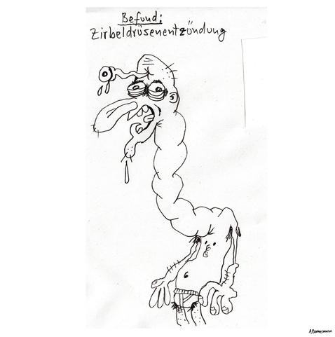 Zirbeldrüsenentzündung.