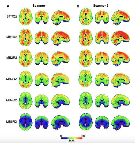 #Multiband acquisition increases #FMRI signal dropout (from Wall, 2023)