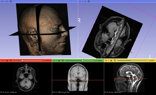Various views of MRI scans of my head. 

Clockwise from top-left:
Volume rendering
3d view of different series
Side view
Back view
Top view