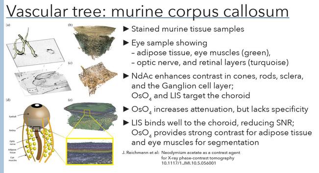 5. Vaskulärer Baum: murines Corpus Callosum: Dieser Abschnitt beschäftigt sich mit der bildlichen Darstellung von Gewebeschnitten und hebt die Färbung verschiedener Gewebetypen hervor, um die Struktur von Blutgefäßen in der Maushirnrinde zu zeigen.
