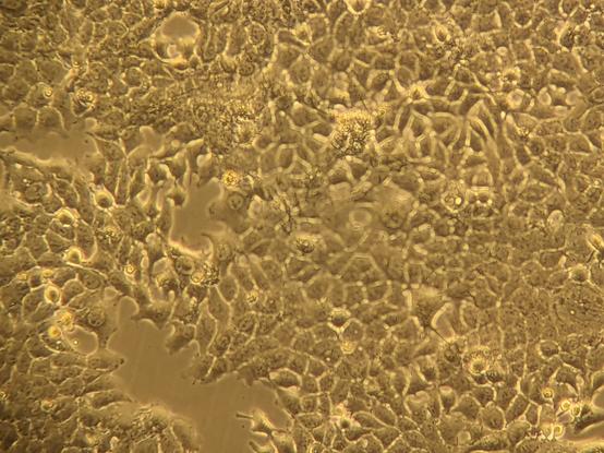 Almost confluent flask of H35 cells