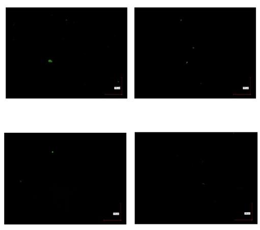 Four panels of my blood, the bright green fluorescent not-severe microclots are barely visible specks, this is how we want our blood to look