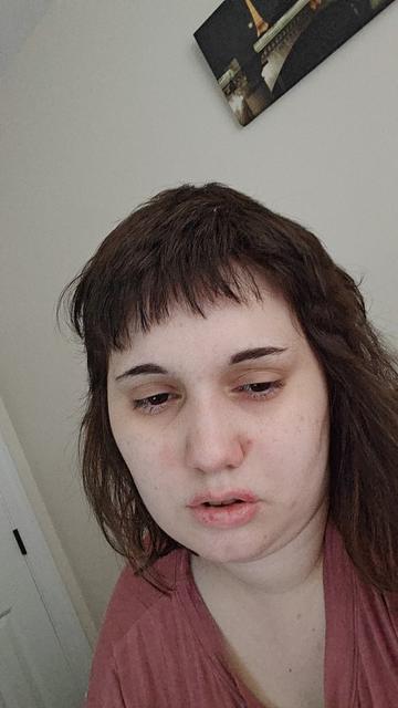 Erika, sick, with a pale face and dehydration.