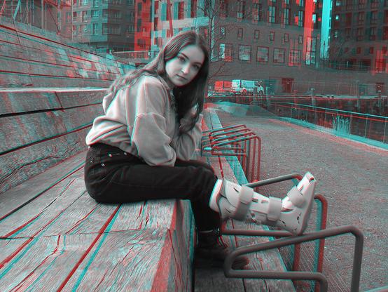 Anaglyphes 3D Bild einer jungen Frau, die mit einem Aircast Walker auf einer Holzbühne sitzt.