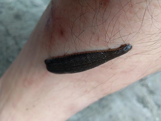 a chonky leech sucking blood from my hairy leg
