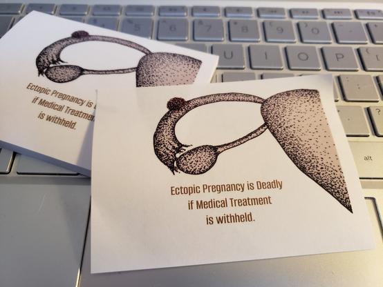 Sticky notes, sitting on my laptop keyboard. The drawing on the sticky notes is a stylized representation of an ectopic pregnancy. The text says "Ectopic pregnancy is deadly if medical treatment is withheld."