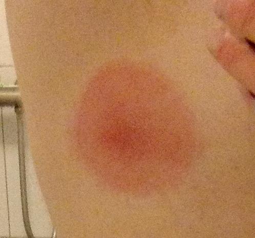 The circle of doom. ⭕️