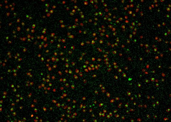 fluorescence microscopy picture showing individual cells of amoebae (red) eating smaller bacterial cells (green)