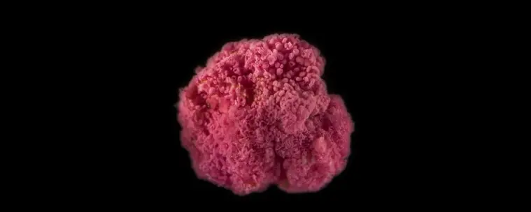 photo of a bright pink clump of bacteria