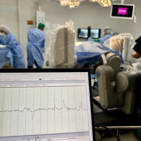 An OR environment with a focus on a screen displaying an EEG trace in the foreground and medical staff attending to a patient with a robotic surgical device in the background.