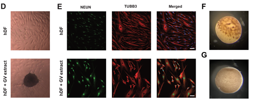 Figure 4D-G in the article. (D) hDF formed and maintained as embryoid bodies on day 15 after GV extract treatment. The dark area in the lower figure is an embryoid body. (E) GV-extract treated hDF shows the expression of neuronal differentiation markers on day 21 after neuronal differentiation. NEUN (in green) and TUBB3 (in red) are markers for neuronal differentiation. The nuclei are stained by DAPI (in blue). Scale bar: 50 µm. (F) Image shows the unfertilized egg (metaphase II) 8 h after injecting adult human lung stem cell nuclei. (G) Image shows the oocyte in meiotic prophase I 3 days after the injection of adult human lung stem cell nuclei.