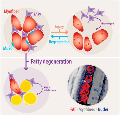 Graphical abstract of the review, featuring FAPs in their normal environment in healthy muscle, and during regeneration, but aslo in pathological contexts leading to fatty degeneration and IMAT formation