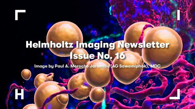 Decorative image; Helmholtz Imaging Best Scientific Image Contest 2024 winner Paul Morocho Jaramillo