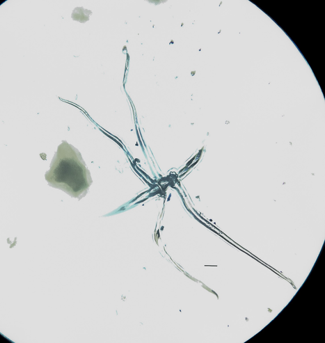 A microscopic image of conjoined plant cells, with a central line of several cells and four tentacle like appendages spanning out from the centre