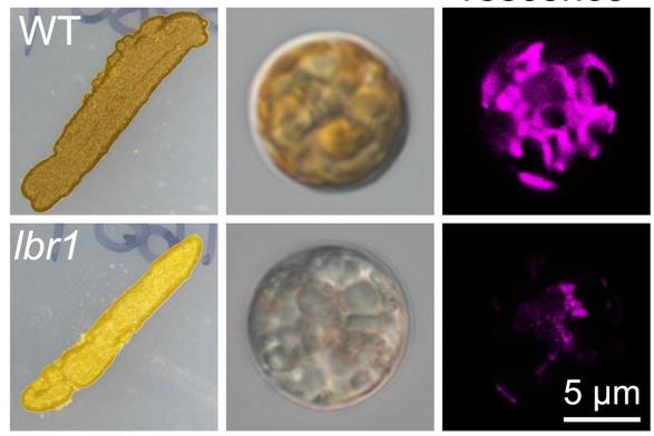 microscopic photos of a single-celled alga
